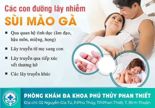 Nguyên nhân gây bệnh sùi mào gà ở nam giới