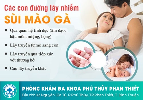Nguyên nhân gây bệnh sùi mào gà