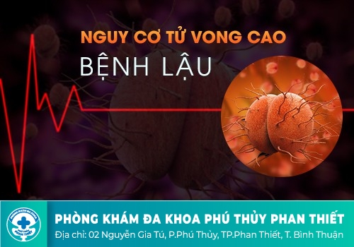 Bệnh lậu là gì?