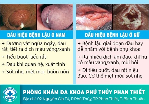  triệu chứng bệnh lậu 