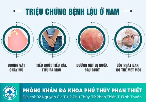 Triệu chứng bệnh lậu
