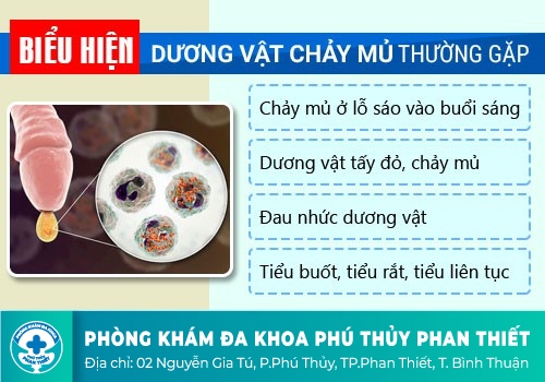 Làm gì khi bị chảy mủ ở bộ phận sinh dục nam?