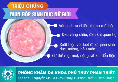 Dấu hiệu nhận biết mụn rộp sinh dục nữ