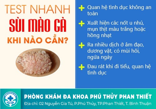 Bệnh sùi mào gà là gì?