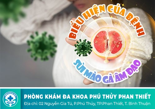 Nguy hại của sùi mào gà ở âm đạo