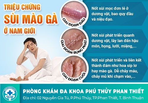 Dương vật nổi mụn thịt dấu hiệu bệnh lý nguy hiểm
