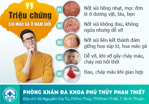 Dấu hiệu sùi mào gà dương vật