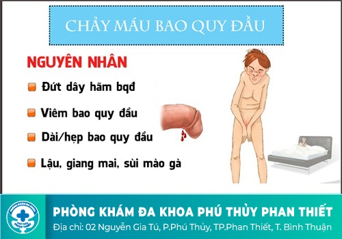 Nguyên nhân khiến dương vật chảy máu ở nam giới