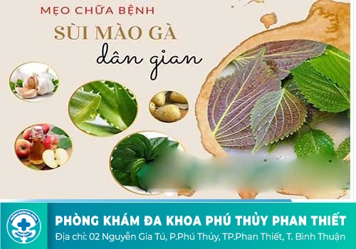 Chữa bệnh sùi mào gà tại nhà có tốt không?