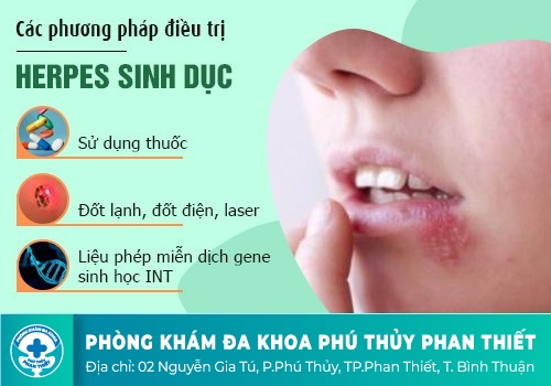 HỖ TRỢ ĐIỀU TRỊ GAI Ở CƠ QUAN SINH DỤC NHƯ THẾ NÀO?