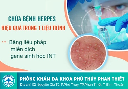 Hỗ trợ điều trị mụn rộp sinh dục như thế nào?