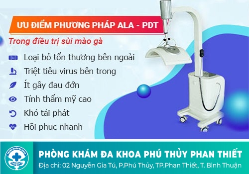 Phương pháp ALA – PDT là gì?