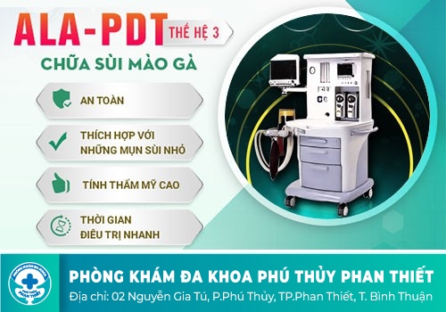 Khám bệnh sùi mào gà 