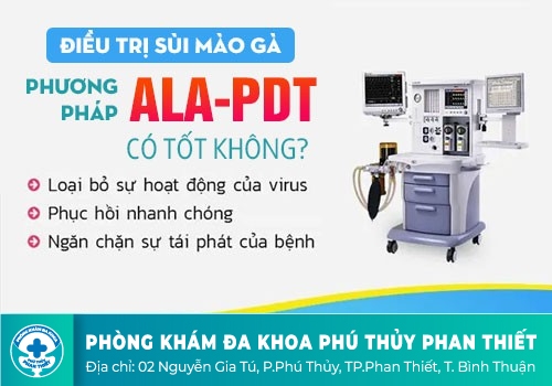 Cách Chữa Bệnh Sùi Mào Gà Hiệu Quả Và Hạn Chế Tái Phát