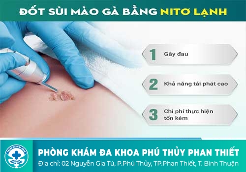 Đốt sùi mào gà có trị hiệu quả được không?
