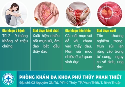 Hình ảnh sùi mào gà qua từng giai đoạn phát triển