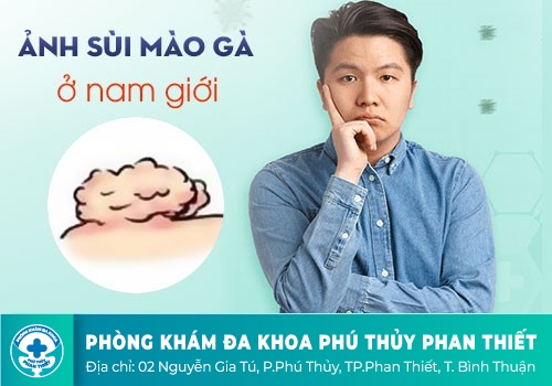 BỆNH SÙI MÀO GÀ DƯƠNG VẬT LÀ GÌ?