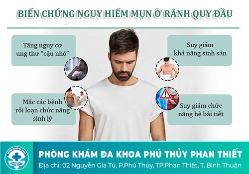 Mụn thịt dương vật là bệnh gì?