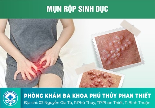 Các bệnh xã hội thường gặp hiện nay