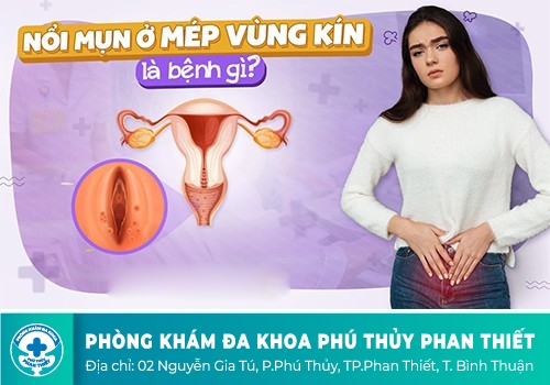 Bị nổi mụn vùng kín phải làm sao đây?