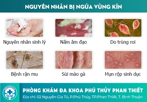 Ngứa Đường Tiểu Là Dấu Hiệu Bệnh Gì?