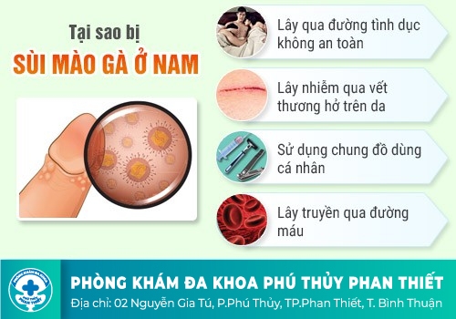 NGUYÊN NHÂN GÂY SÙI MÀO GÀ Ở NAM GIỚI