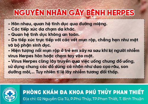 Bệnh Herpes sinh dục là gì?