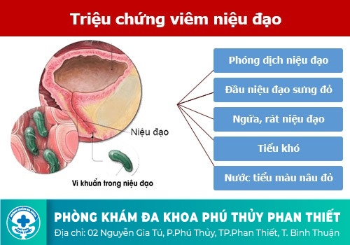 NGUYÊN NHÂN GÂY TIỂU RA MÁU, ĐÁI RA MÁU Ở CẢ NAM VÀ NỮ GIỚI