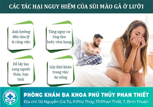 Triệu chứng của bệnh sùi mào gà ở lưỡi