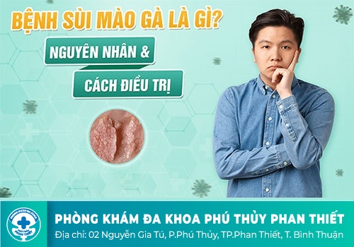 Dương vật nổi mụn thịt – Dấu hiệu bệnh sùi mào gà