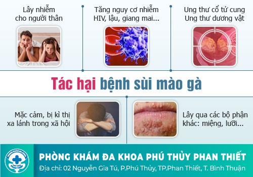 Sùi mào gà (Mụn cóc sinh dục)