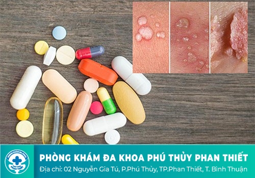 Thuốc đặc trị chữa sùi mào gà