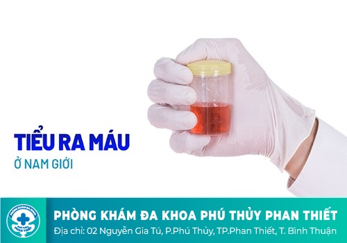 Tiểu buốt kèm theo máu là gì?