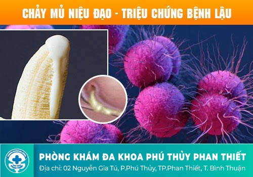 BỆNH LẬU LÀ GÌ?