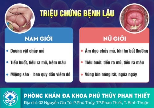 Tiểu ra mủ