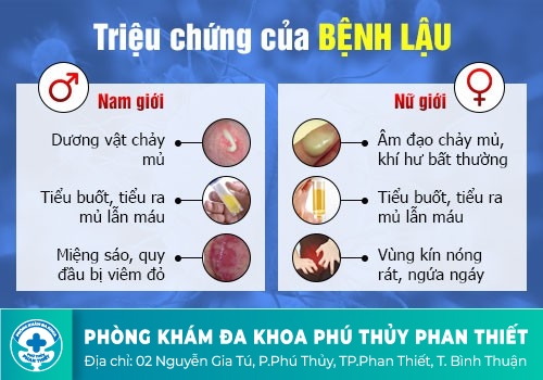 Dấu hiệu bệnh lậu ở nam và nữ giới 
