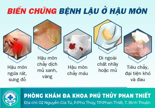 Đi ngoài ra máu tươi là bị gì