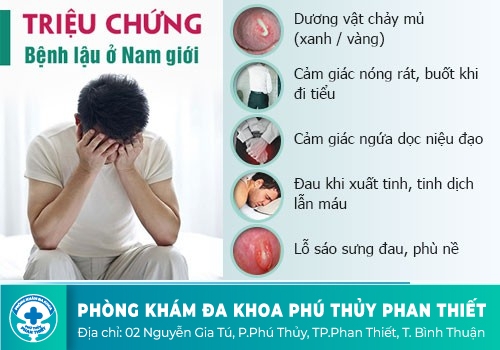 Biểu hiện của bệnh lậu mãn tính ở nam giới