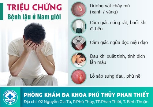 Giải đáp dương vật bị ngứa và chảy mủ là bệnh gì