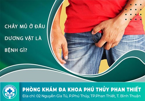 Chảy mủ sinh dục ở nam giới là bệnh gì?