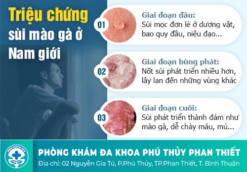 Dương vật có mùi hôi là bệnh gì?