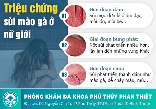 Môi nhỏ sần sùi là bệnh gì?