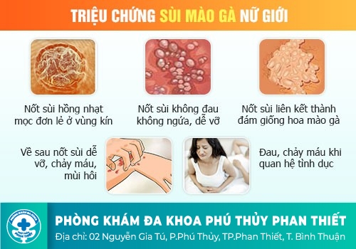 Biểu hiện sùi mào gà ở nữ giới
