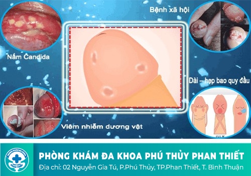 Dương Vật Bị Tróc Da Ngứa Là Dấu Hiệu Bệnh Gì?