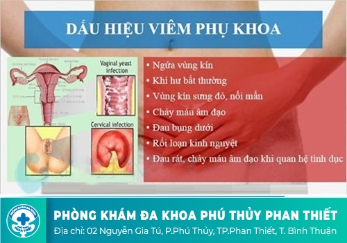 Chảy mủ ở âm đạo do bệnh viêm nhiễm phụ khoa