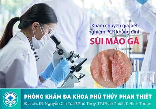 Vì sao nên đi xét nghiệm sùi mào gà? Xét nghiệm sùi mào gà khi nào?