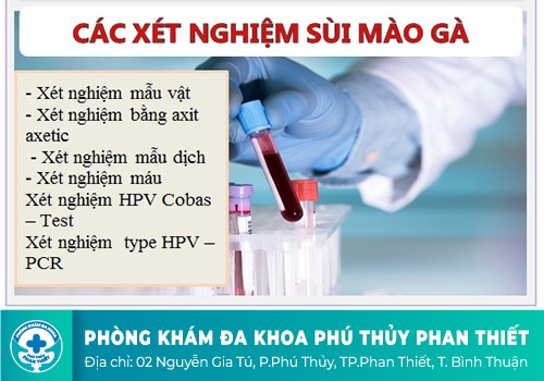 Phương pháp xét nghiệm sùi mào gà