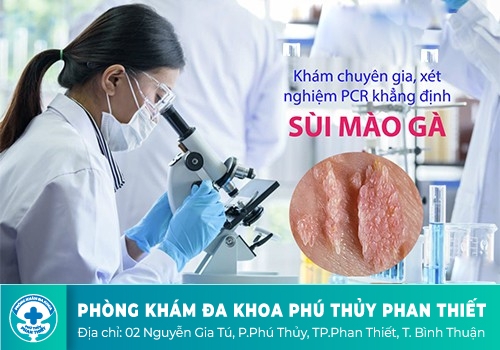 Những điều cần biết trước khi đi xét nghiệm bệnh xã hội