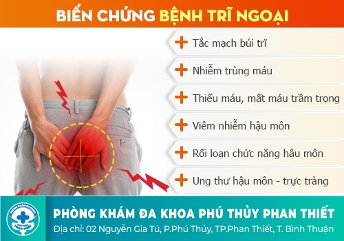 Bệnh trĩ ngoại có nguy hiểm không?