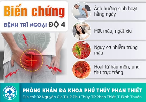 Tác hại đáng sợ nếu coi thường bệnh trĩ ngoại